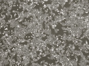 HEK cells (seen here at 100 times their actual size) are used as concor receptor factories to study the effects of environmental contaminants on reproduction. Photo by Rachel Felton