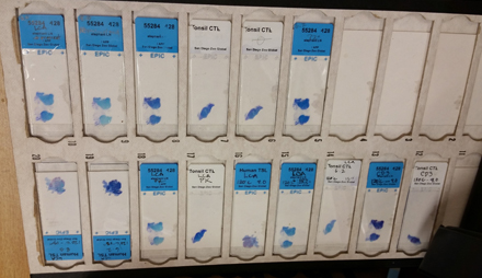 Here are blue-stained slides, one of the “typical” colors used to differentiate between organelles. After they are stained, the slides can be looked at under a microscope to see various abnormalities in question. If it is bacteria or fungus, Dr. Bernard and Dr. Cartoceti would be able to identify it because of the shape of the organism. However, sometimes pathologists are unable to identify a specific pathogen, but they can eliminate contagious diseases which could potentially affect the other animals in the collection.